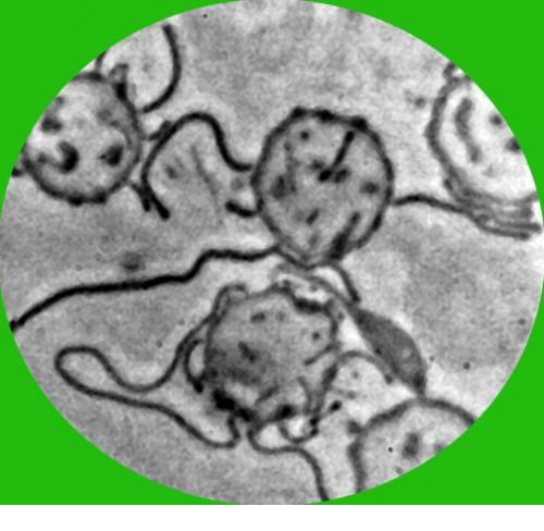 Morgellons-lyme-borrelia_bacteria