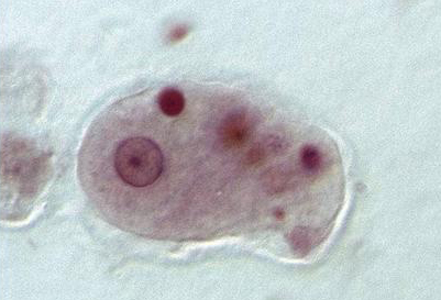 NHSOA-4-pillars-of-health-parasites-1a